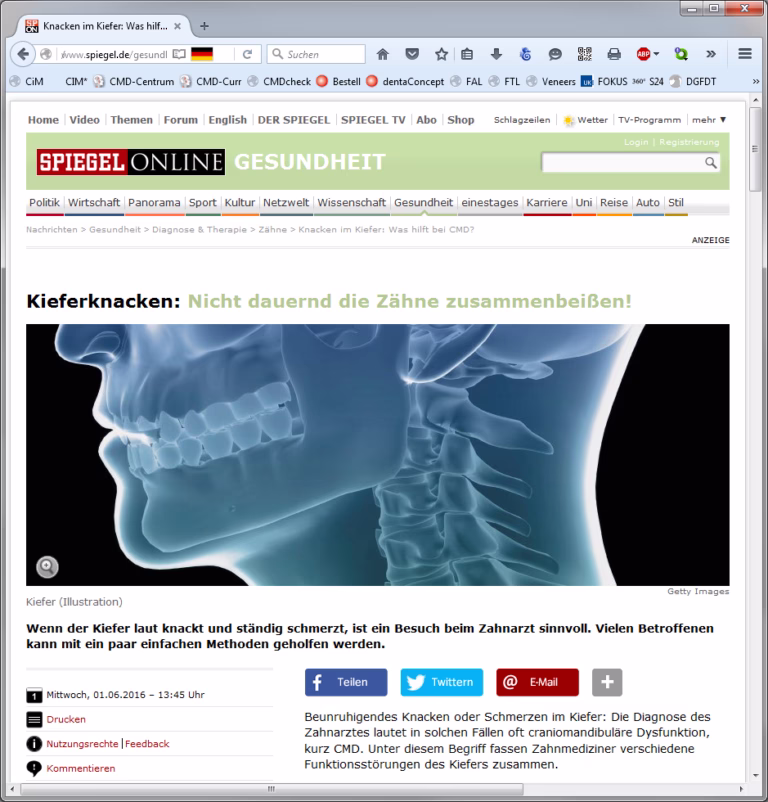 Beitrag-uber-CMD-01062016