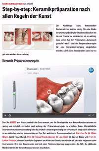 Step-by-Step---Keramikpraparation-nach-allen-Regeln-der-Kunst-_ZWP-2018-03-02_-Thumb